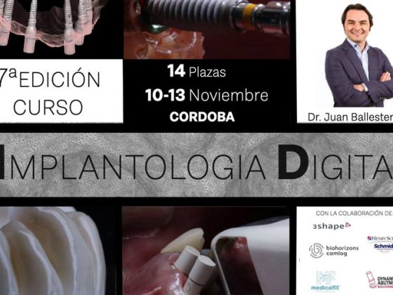curso de implantología digital. Juan Ballesteros, protocolos Medicafit