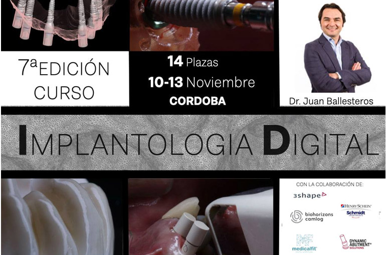 curso de implantología digital. Juan Ballesteros, protocolos Medicafit
